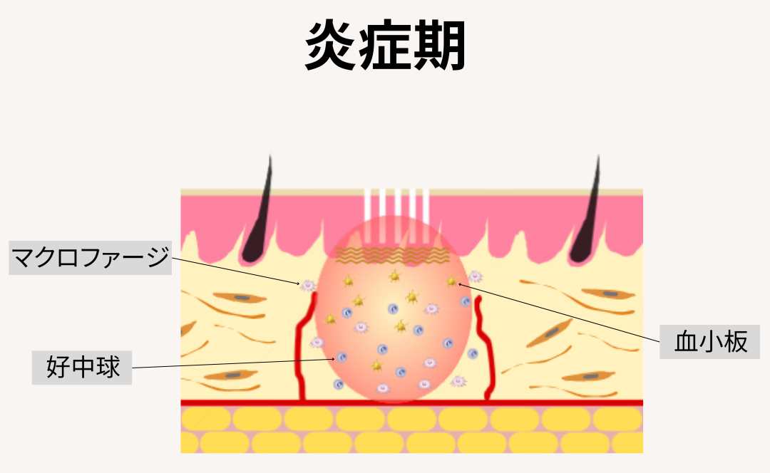 ダーマペン - Medical Skin Design